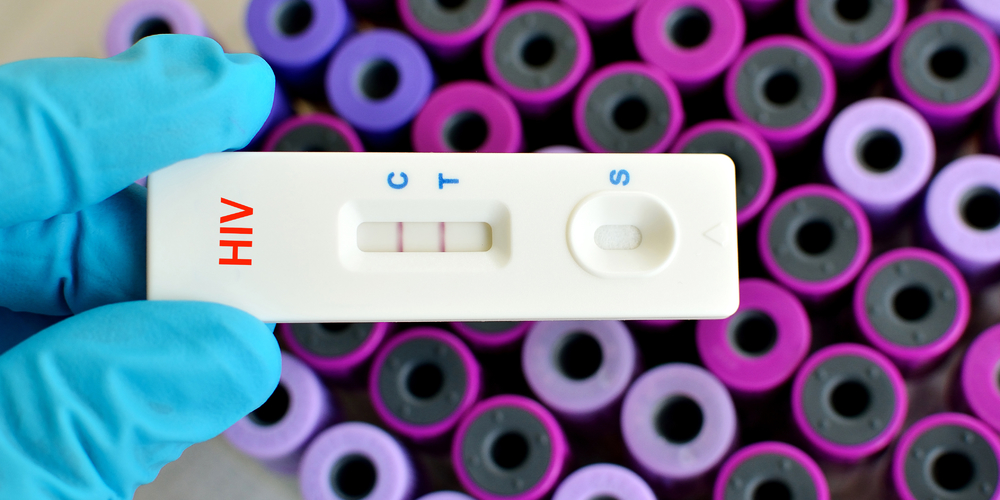 Instant Results At Home Sti Test Kits Are They Accurate And How Do They Work 