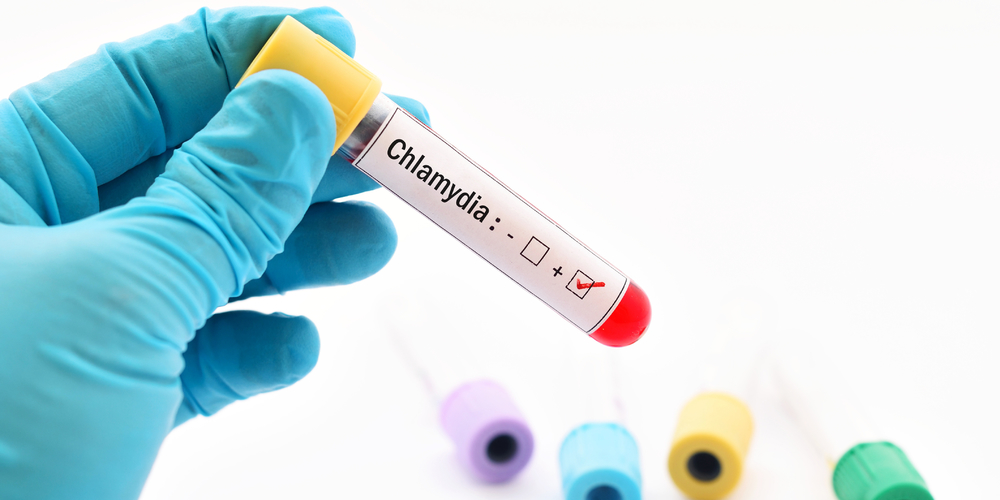 How To Cure Chlamydia Without Going To The Doctor   Positive Chlamydia Blood 